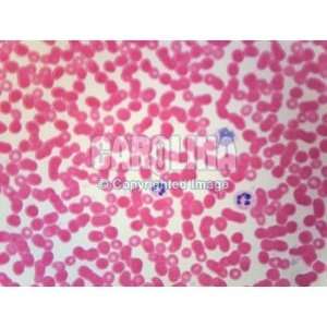 Human Blood, smear Microscope Slide  Industrial 