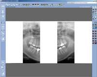   Tokyo Dental College, Vol. 35, No. 3, pp. 127–131, August, 1994