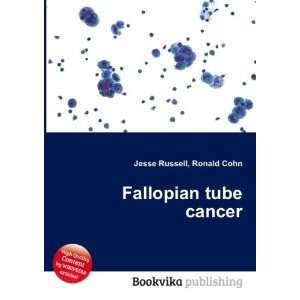  Fallopian tube cancer Ronald Cohn Jesse Russell Books