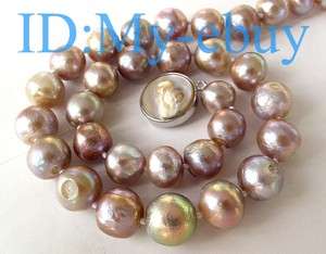   Purple Baroque Pearl Necklace Blister Pearl Clasp 18 or 20  