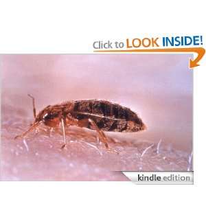 Bed Bugs How to Prevent and Treat this Treat Diane Hamel  