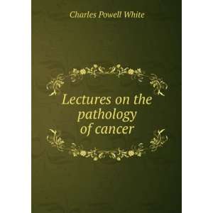   on the pathology of cancer Charles Powell White  Books